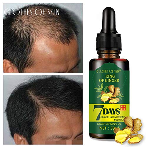 Hair Growth Serum,Hair Growth Essential Oil,Hair Serum,Hair Oil For Hair Growth- Hair Growth & Hair Thickening,Natural Herbal essence Anti Hair Loss Hair Serum