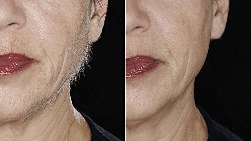 Hollywood Browzer Maquinillas de afeitar dermaplaning para rostro, modelado de cejas, eliminación de vello no deseado, herramienta exfoliante para mujeres Oro rosa