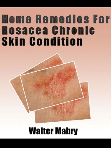Home Remedies For Rosacea Chronic Skin Condition (English Edition)