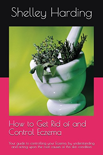 How to get Rid of and Control Eczema: Your guide to controlling your Eczema, by understanding and acting upon the root causes of this skin condition