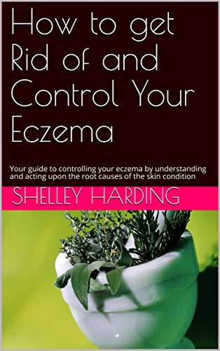 How to get Rid of and Control Your Eczema: Your guide to controlling your eczema by understanding and acting upon the root causes of the skin condition (English Edition)