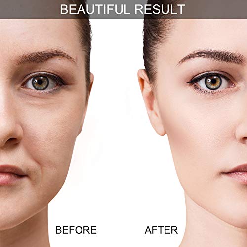 Juego de Ventosas Faciales Masaje Ahuecamiento de Cara y Ojos, Set de Ventosas Faciales Tazas de Silicona con Cepillo Exfoliante para Cara Cuello Piel (Pequeño Mediano Grande, Rosa)