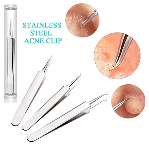 Kit de 6 pinzas extractoras para remover puntos negros, kit de herramientas para extraer granos de comedón, acné, granos y puntos negros, fácil para la piel de la nariz sin riesgo de imperfecciones
