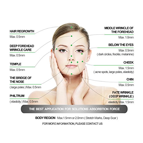 Koi Beauty Dermaroller 3 en 1 Kit, incluye 1.5 mm / 1200 tips para cuerpo, 1.0 mm / 600 para facial, 0.5 mm / 180 para ojos