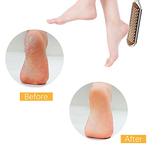 Lima de Pies Premium Removedor de callos para pedicuras - Raspador de pie profesional para el cuidado de los pies Doble cara para eliminar la piel muerta (Cobre)
