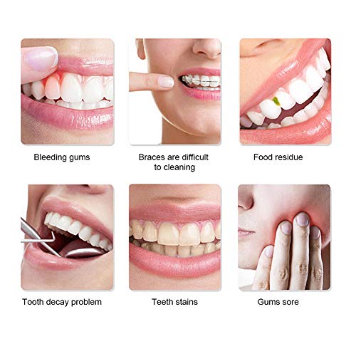 Limpiador de dientes con irrigador bucal, irrigador bucal, irrigador bucal eléctrico portátil para el hogar, máquina de limpieza de dientes profesional impermeable IPX8 para viajes en casa