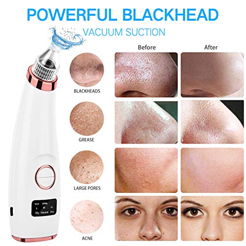 Limpiador de Poros, QARFEE Extractor de Puntos Negros Facial Electrico Blackhead Remover Eliminador USB Recargable con Pantalla LED para Espinillas y Acné