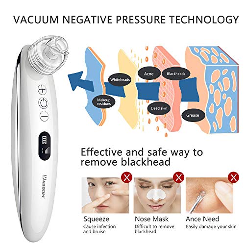 Limpiador de Poros,Extractor de Puntos Negros Eliminador De Espinillas y Acné Aspiradora Facial Limpiador Facial Electrico Succionador al vacio de Quita Puntos Negros y Espinillas Remover con 4 sondas