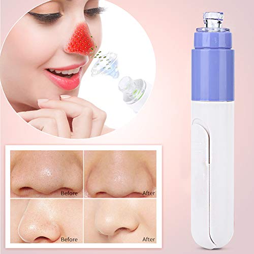 Limpiador Puntos Negros electrico, Eliminador de Espinillas de Succión de Puntos Potente Dispositivo de Atención de Acné de Espinillas para la Nariz de la Cara
