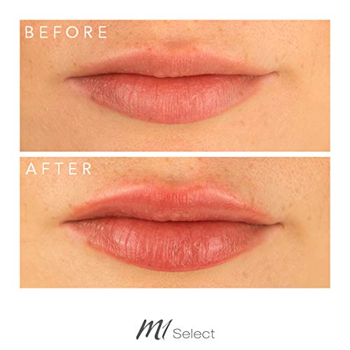 LIPBOOSTER – Cuidado de labios para más volumen de labios en segundos – con capsaicina y mentol – de médicos alemanes – 5 ml de M1 SELECT