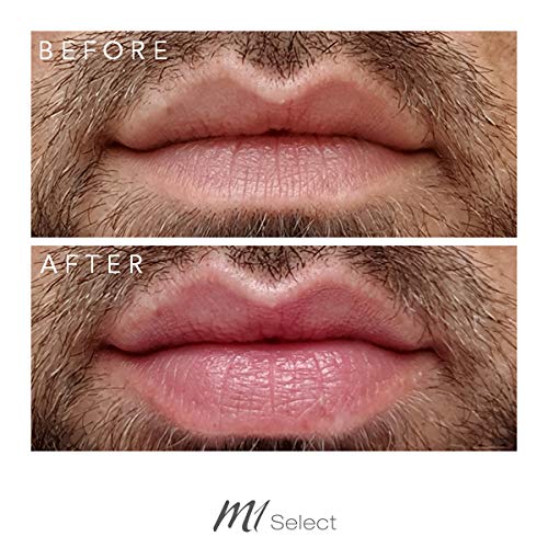 LIPBOOSTER – Cuidado de labios para más volumen de labios en segundos – con capsaicina y mentol – de médicos alemanes – 5 ml de M1 SELECT