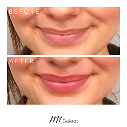 LIPBOOSTER – Cuidado de labios para más volumen de labios en segundos – con capsaicina y mentol – de médicos alemanes – 5 ml de M1 SELECT