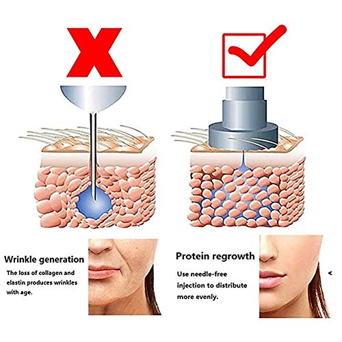 LZDYC Pluma de inyección de ácido hialurónico, nebulizador sin Aguja, no invasivo, indoloro, antienvejecimiento, Equipo Antiarrugas, suplemento Profundo Rico en nutrientes