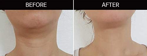My Formula - My Neck Mask Whitening, Mascarilla Coreana De Cuello Para Hidratar y Unificar El Tono, 5 Unidades
