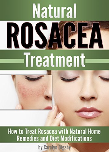 Natural Rosacea Treatment: How to Treat Rosacea with Natural Home Remedies and Diet Modifications (English Edition)