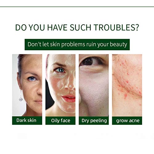 OHQ Aloe Vera Gel LocióN Hidratante Crema Facial Perfectamente Liso para India Efecto Calmante E Hidratante (150ML, Verde)