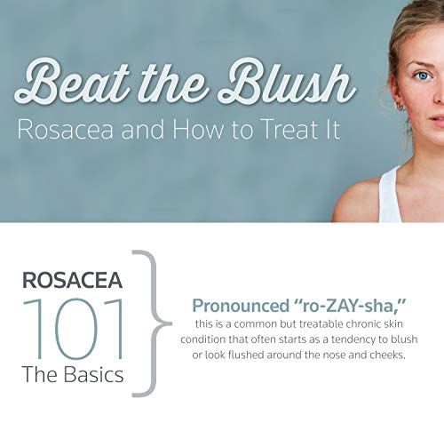 Prosacea Rosacea Treatment Gel .75 oz (21.25 g)
