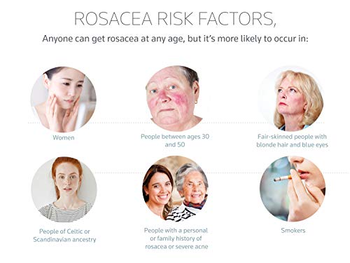 Prosacea Rosacea Treatment Gel .75 oz (21.25 g)