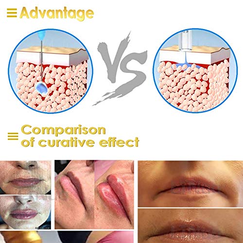 QIYE 16pcs Reemplazo Hyaluron Pen Accesorios 0.3ml, consumibles Desechables Ampollas estériles Suministros de Belleza para el ácido hialurónico Pluma Salón de Belleza