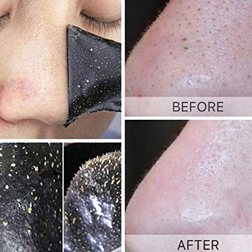 Soldmore7 - Tiras de carbón vegetal antiespinillas intensivas, reducen los poros de la nariz y el acné, elimina espinillas, no obstruye la piel, No cero., Negro
, 50 pcs