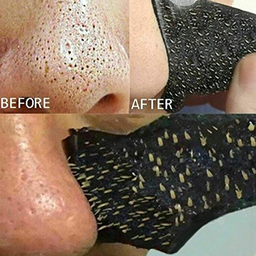 Soldmore7 - Tiras de carbón vegetal antiespinillas intensivas, reducen los poros de la nariz y el acné, elimina espinillas, no obstruye la piel, No cero., Negro
, 50 pcs