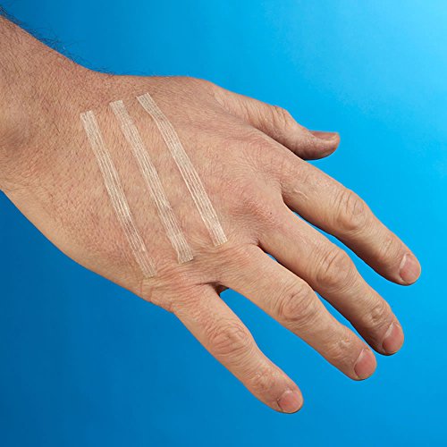 Steroplast Suturas cutáneas