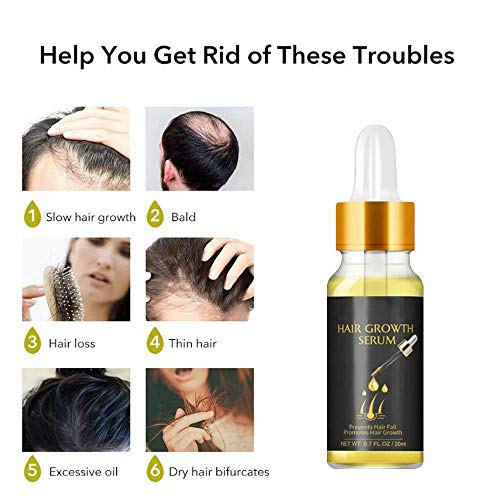 SZSCUTE Extra Biotin Herbal Serum-20ml, Fast Hair Growth Serum Essential Oil Hair, Hair Care Essence Plant Extract Conditioner Anti-Ginger Shampoo Hair Conditioner