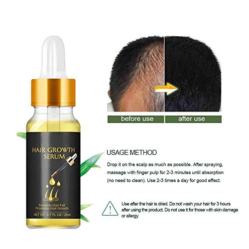 SZSCUTE Extra Biotin Herbal Serum-20ml, Fast Hair Growth Serum Essential Oil Hair, Hair Care Essence Plant Extract Conditioner Anti-Ginger Shampoo Hair Conditioner