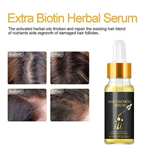 SZSCUTE Extra Biotin Herbal Serum-20ml, Fast Hair Growth Serum Essential Oil Hair, Hair Care Essence Plant Extract Conditioner Anti-Ginger Shampoo Hair Conditioner