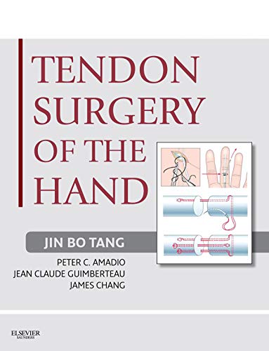 Tendon Surgery of the Hand E-Book: Expert Consult - Online and Print (English Edition)
