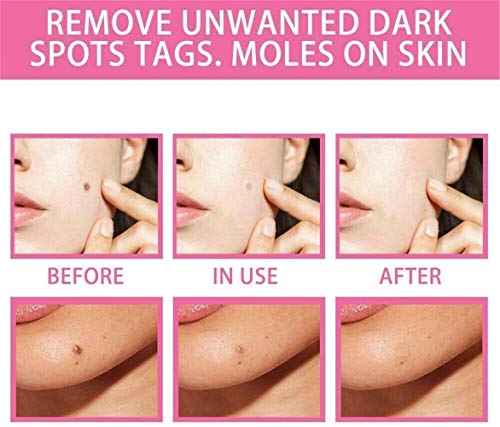 TTCPUYSA 2pcs Organic Tags Solutions Serum,Mole and Skin Tag Remover and Repair Cream Oil, Effectively Remove Freckle Pigmented/Melanin Spots/Face Wart Tag