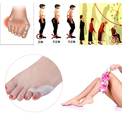 ULTNICE 2Pcs Pinky Toe Straightener Toe Separator (Blanco)