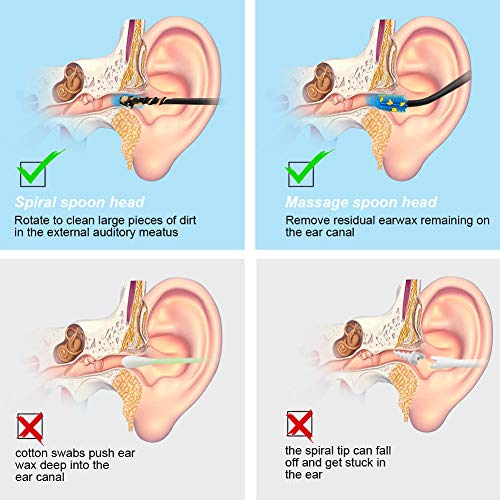 Vicloon Limpiador de Oídos, 5 Piezas Removedor de Cera de Oído con Caja de Almacenamiento y Cepillo de Limpieza, Limpieza Cerumen Oído para Bebés, Jóvenes y Adolescentes Adultos