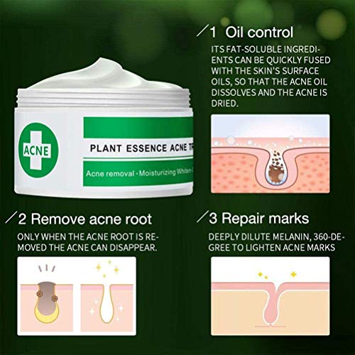 Wiivilik Esencia de la Planta Anti acné Crema Facial Que blanquea la peca Crema Quitar Melasma acné Marcas Pigmento melanina Manchas oscuras Cuidado de la Cara Suero Crema para el Rostro