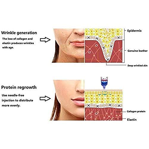 WRQ 5Pcs 0,3 Ml Cabeza Ampolla Estéril para Atomizador Pluma Hialurónica Consumibles Jeringa Agua Desechable Pistola Hialurónica Eliminación Arrugas Antienvejecimiento