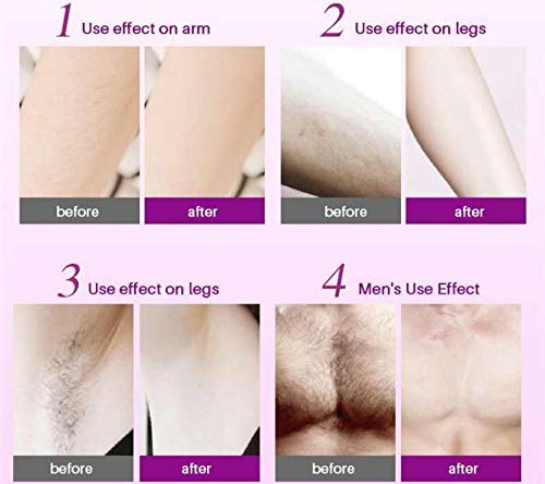 YMSM Hair Enemy Bubble Spray Hair Removal Cream Used On The Legs, Chest, Armpits and Other Areas That Need Hair Removal