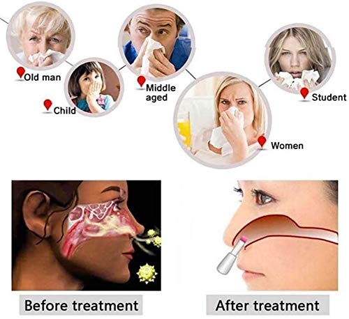 ZBYL Monitor Tool Terapia Rinitis Nariz Dispositivo Terapéutico De La Rinitis Instrumento Fisioterapia Salud