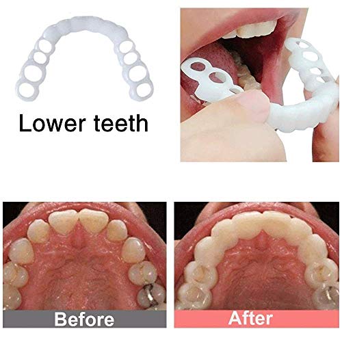 ZHQY Dental Cosméticos carillas, Carillas Dientes Cosméticos Whitening Cosmetic Teeth Covers Snap on Smile Veneer Safe Effective Easy to Use Affordable Teeth Veneers 1 Pair