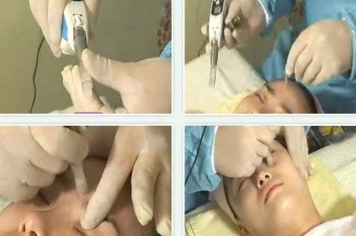 20 pièces 12 broches de remplacement Dermapen Aiguilles Cartouches pour auto Derma Stamp Pen