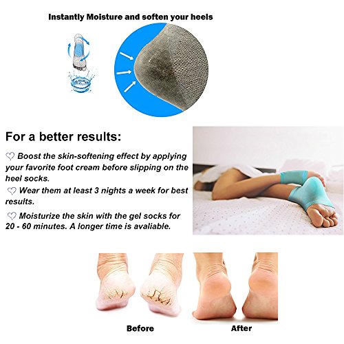 5 Pares calcetines hidratantes, calcetines de gel para el talón, calcetines abiertos para aliviar el dolor del talón, cómodos y suaves, con ventilación, para el cuidado de la piel seca y agrietada