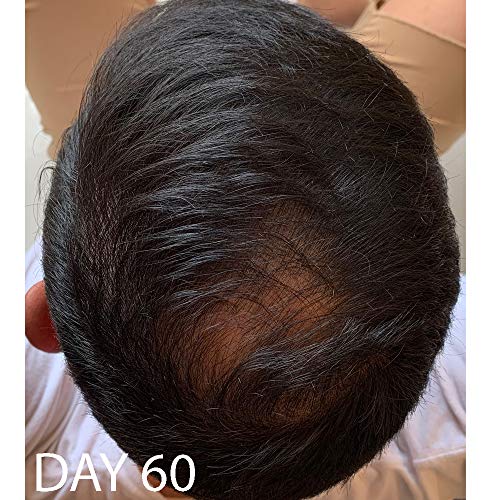 Acondicionador Biotin Vitamin Hair Growth-(Alta Potencia) Acondicionador Biotin para el crecimiento de vello más rápido, Acondicionador Anti Pérdida de Cabello, Vitaminas E, A y C, 8.5oz.