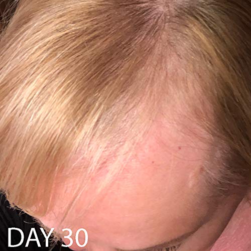 Acondicionador Biotin Vitamin Hair Growth-(Alta Potencia) Acondicionador Biotin para el crecimiento de vello más rápido, Acondicionador Anti Pérdida de Cabello, Vitaminas E, A y C, 8.5oz.