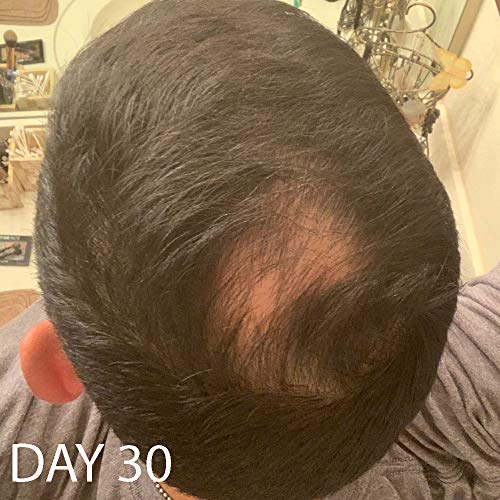 Acondicionador Biotin Vitamin Hair Growth-(Alta Potencia) Acondicionador Biotin para el crecimiento de vello más rápido, Acondicionador Anti Pérdida de Cabello, Vitaminas E, A y C, 8.5oz.