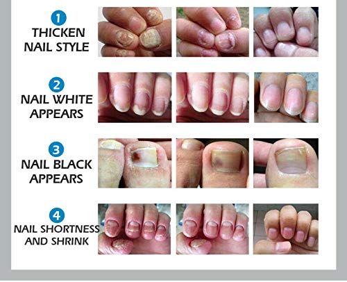 Adayo Vibrant Glamour Crema reparadora de uñas para Restaurar Hermosas uñas (2 Botella)