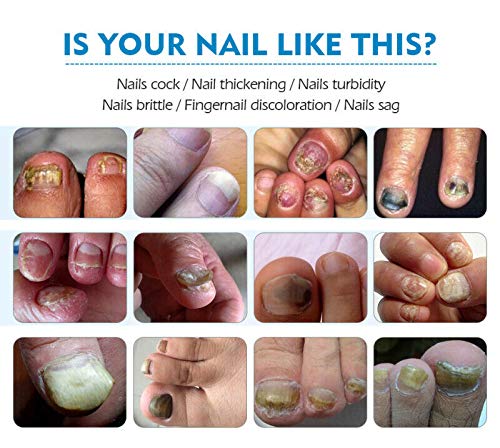 Adayo Vibrant Glamour Crema reparadora de uñas para Restaurar Hermosas uñas (2 Botella)