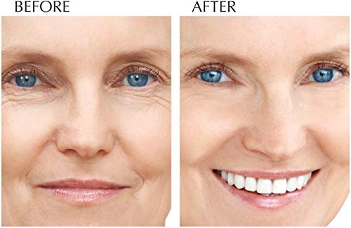 Advanced Clinicals Retinol Cream. Spa Size for Salon Professionals. Moisturizing Formula Penetrates Skin to Erase the Appearance of Fine Lines & Wrinkles. Fragrance Free. 16oz by Advanced Clinicals