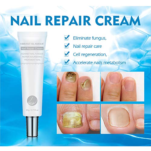 AMYGG Tratamiento de Uñas Crema Reparación de Uñas Renovar Dañado Roto Agrietado Uñas Descoloridas (2 PCS)
