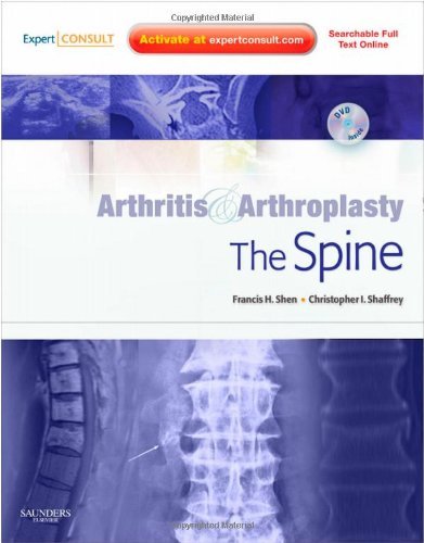 Arthritis and Arthroplasty: The Spine: Expert Consult - Online, Print and DVD, 1e by Francis H. Shen MD (2009-11-24)
