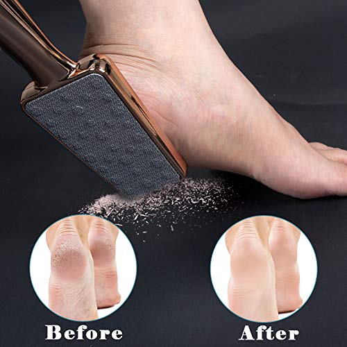 BTNEEU Lima de Pies Profesional Doble Cara, Raspador de Callos de Acero Inoxidable para Eliminar la Piel Dura o Muerta, Lima de Callos con Diseño Ergonómico para Manos y Pies (Dorado)