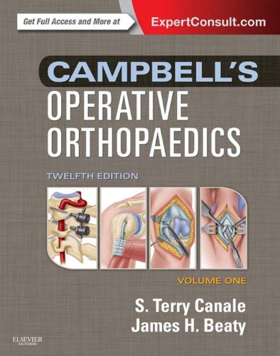 Campbell's Operative Orthopaedics E-Book: Expert Consult Premium Edition - Enhanced Online Features (English Edition)